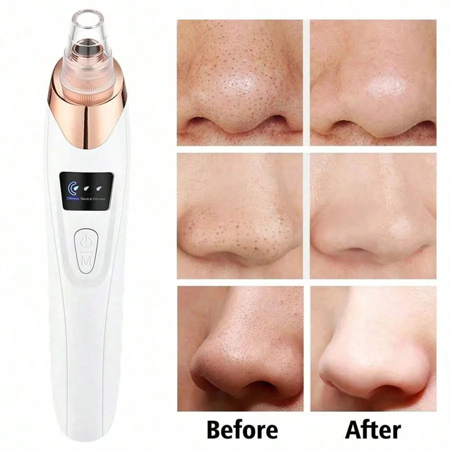 Electric Facial Skin Care Pore Removal Cleanser Vacuum Acne Removal For Deep Facial Pores,Women Blackhead Remover
