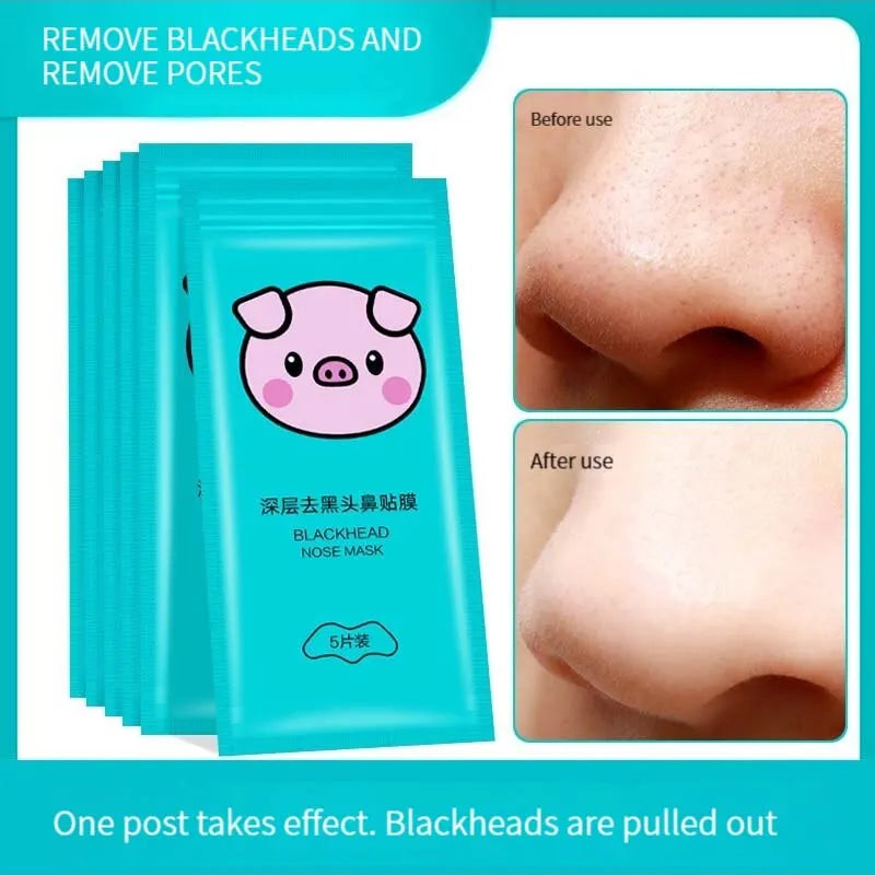 5PCS Blackhead Removal Nasal Strip Acne Magic Powerful Adsorption Mite Remover Deep Cleaning Pore Shrinking Smooth Skin