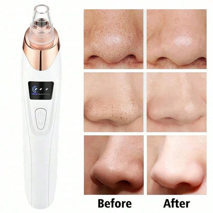 Electric Facial Skin Care Pore Removal Cleanser Vacuum Acne Removal For Deep Facial Pores,Women Blackhead Remover