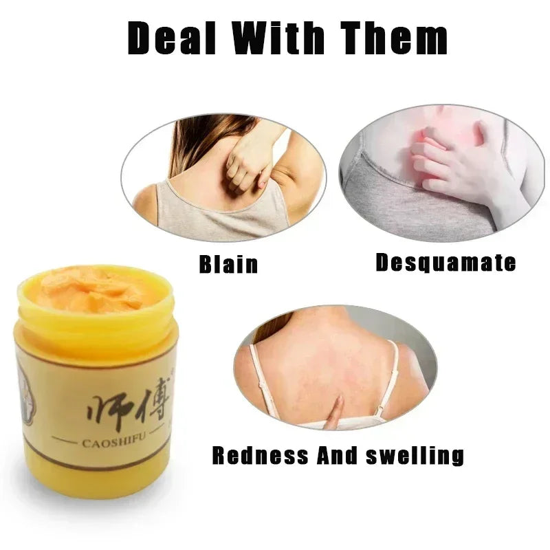 Skin Psoriasis Cream Dermatitis Eczematoid Eczema  Psoriasis Cream Skin Care Cream